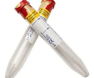 BD 364943 Vacutainer® Urine Collection Straw 8 ml