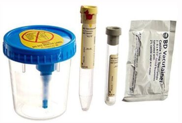 BD 364957 Vacutainer Urine Collection Kit with 8 mL Sterile