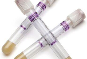 BD 362788 Vacutainer PPT Venous Blood Collection Tube Plasma Tube K2 EDTA 1000/CS