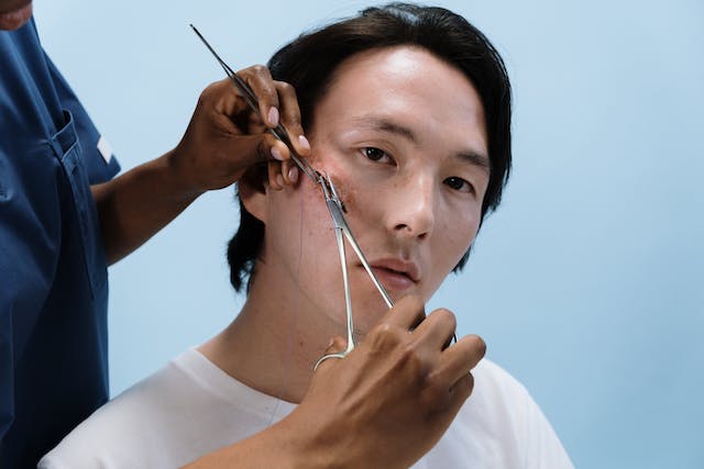 Suturing process of a facial wound being done on a patient