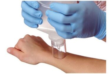 10100 BSN SPLASHCAP WOUND IRRIGATION SHIELDS, CS100