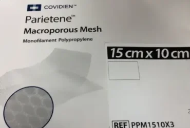 Covidien parietene macroporous mesh 15cm x 15cm