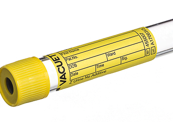 GREINER BIO 455007 VACUETTE Z URINE TUBE 10ml YELLOW 50/PK