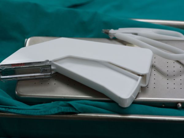 A surgical stapler is being employed during an operation A surgical sA surgical stapler is being employed during an operationtapler is being employed during an operation