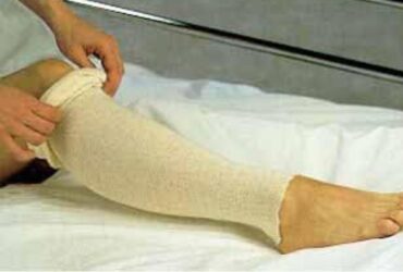 8564 STOCKINETTE TUBULAR COPLEX 6IN