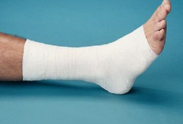 GELOCAST UNNA BOOT 4X10YD