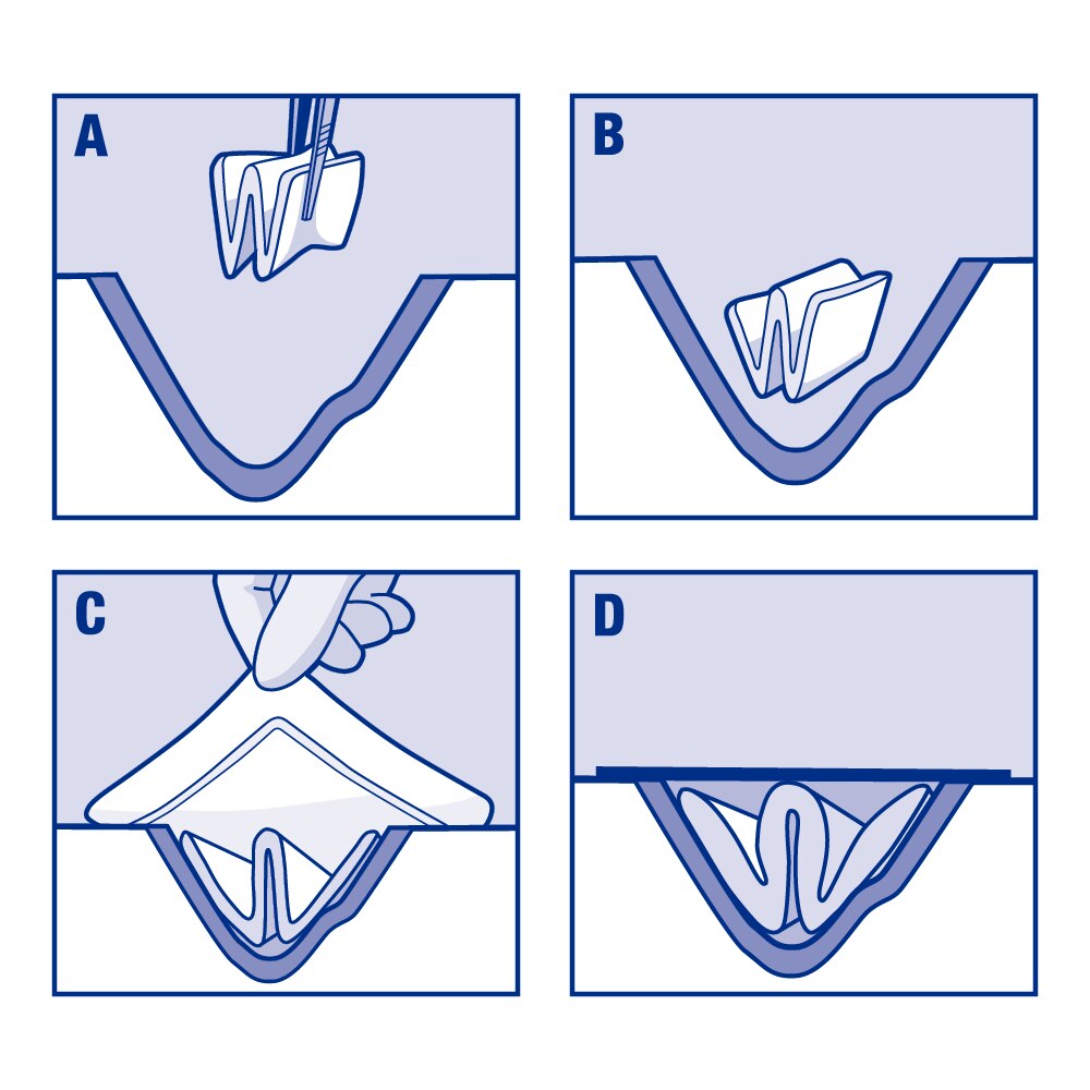 cutimed-how-to-use-cutimed-cavity.jpg CUTIMED CAVITY STERILE FOAM 2INX2 3/8IN