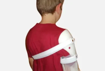 SPECIALIST HUMEROUS FRACTURE BRACE ORTHOSIS W/DEL LG