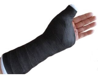 BSN 7212 DELTA CAST Delta-cast conformable 2inx4yd black Box of 10