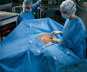 Laparoscopy Pack II Includes: Ultra Surgical Gown with Towel, Laparoscopy T Drape, (2) Leggings, Under Buttocks Drape, Mayo Stand Cover, Ultra Surgical Gown in Overwrap, Back Table Cover, 6/cs