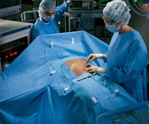 Laparotomy Pack, Includes: Large, Sterile Back, Scrub Nurse Gown; Absorbent Towels (on Gown); Large, Sterile Back, Fabric-Reinforced Gown; 44 x 90 Outer Wrap/Reinforced Poly Table Cover with 24 x 90 Reinforcement, 4/cs