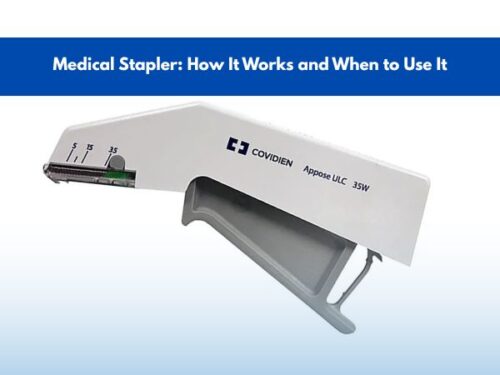 Medical Stapler: How It Works and When to Use It